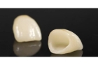 Недорогие коронки из диоксида циркония на зубы