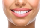 Облицовка передней поверхности зуба