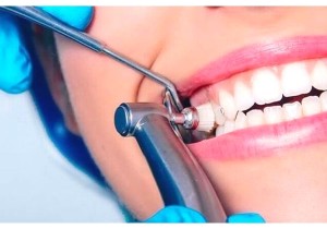 Лечение пульпита четырехканального зуба