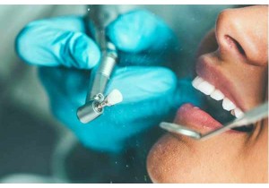 Профессиональная чистка зубов (щетка, паста)