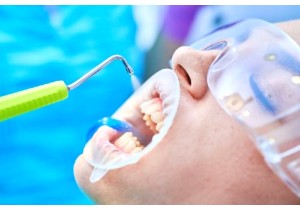 Профессиональная чистка зубов с помощью аппарата «AIR FLOW»